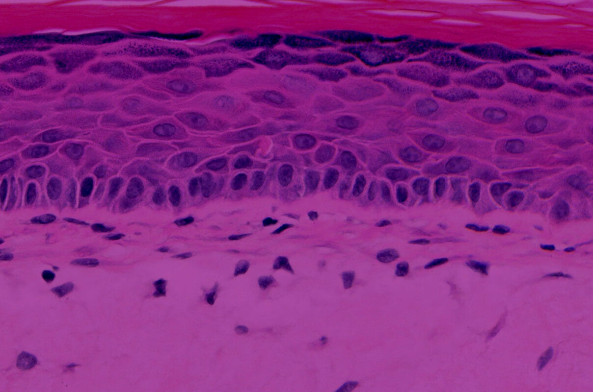 EpiDermFT tissue model histology image