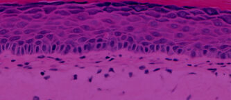 EpiDermFT tissue model histology image