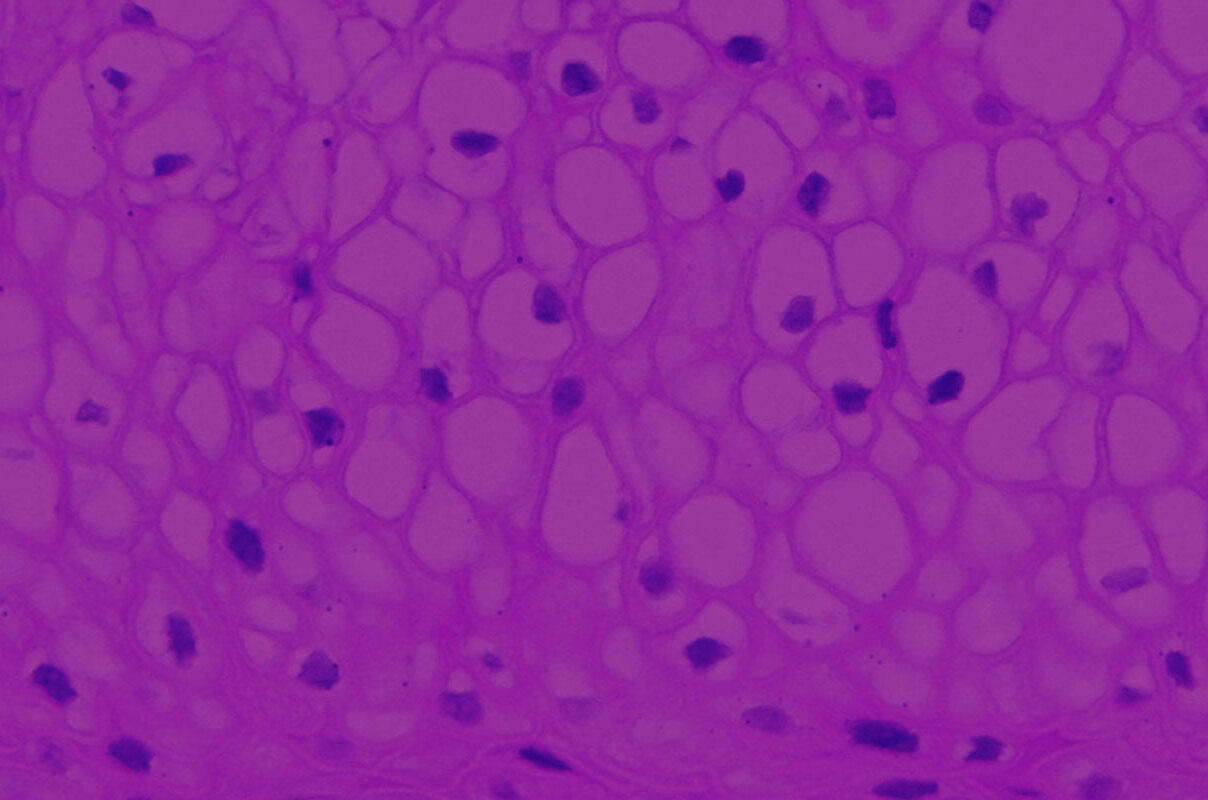 histology of EpiVaginal human tissue model