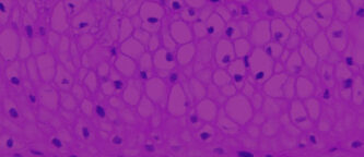 histology of EpiVaginal human tissue model