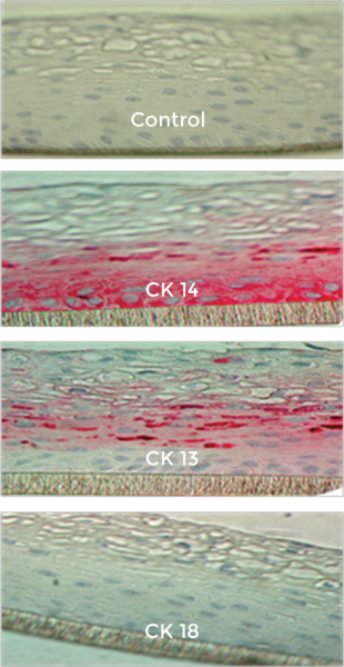 EpiVaginal tissue model histology image of Control. CK14, CK13, and CK18