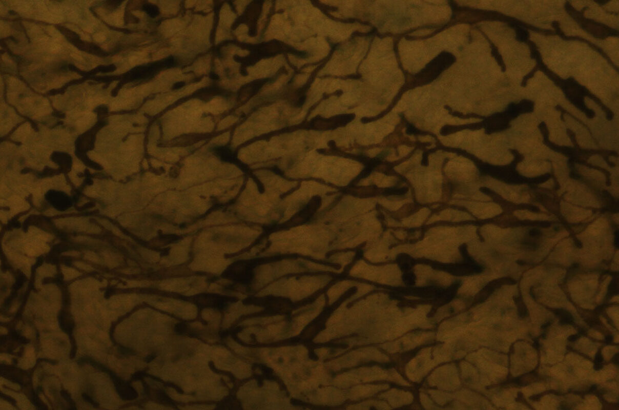 MelanoDerm human tissue model