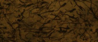 MelanoDerm human tissue model