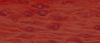 histology of EpiOral and EpiGingival human tissue models