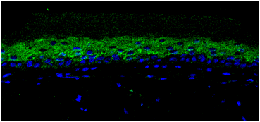 confocal image of involucrin