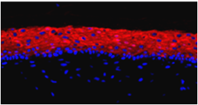 confocal image of Keratin 10