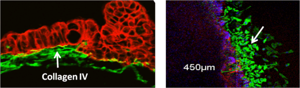 confocal images of Intestinal Fibrosis