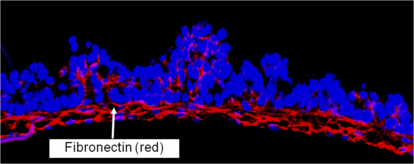 Confocal image of Intestinal Fibrosis