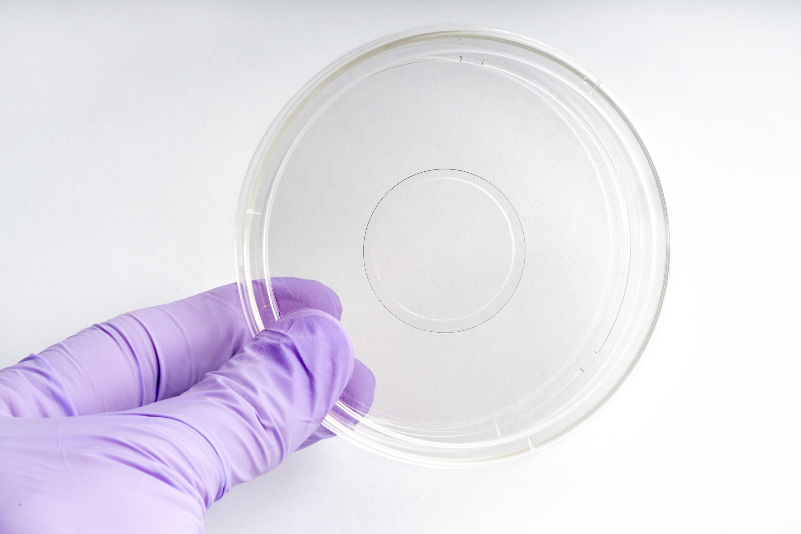 100 mm Dish | No. 1.5 Coverslip | 30 mm Glass Diameter - Image 3