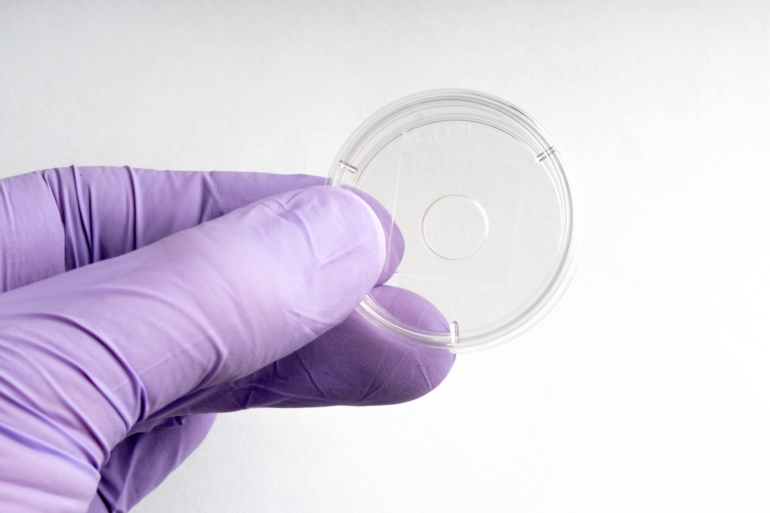 High Adherence | 35 mm Dish | No. 1.5 Coverslip | 10 mm Glass Diameter - Image 2