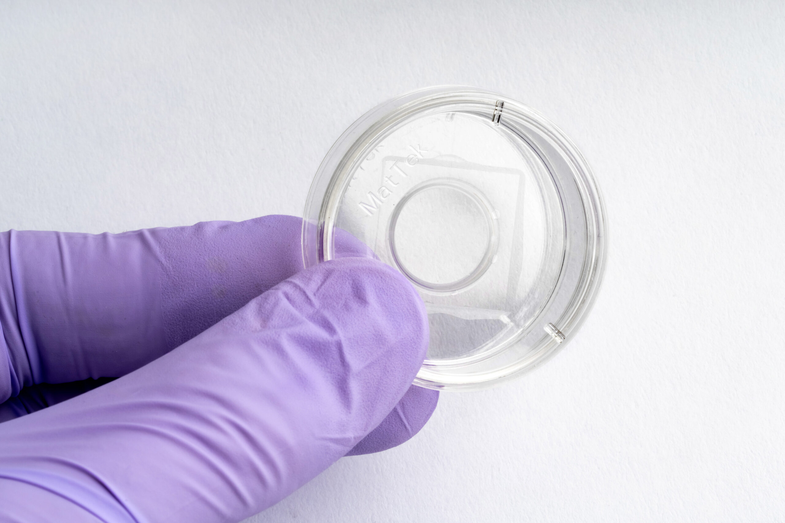 High Adherence | 35 mm Dish | No. 0 Coverslip | 14 mm Glass Diameter - Image 2