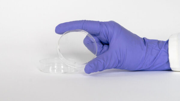 60 mm Dish | No. 1.5 Coverslip | 30 mm Glass Diameter