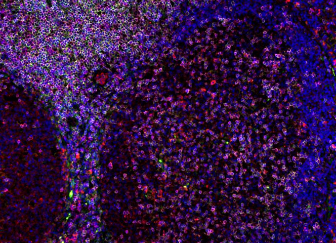 Immunofluorescence staining in FFPE human tonsil of CD3 (magenta), CD4 (green), and PDL1 (red).