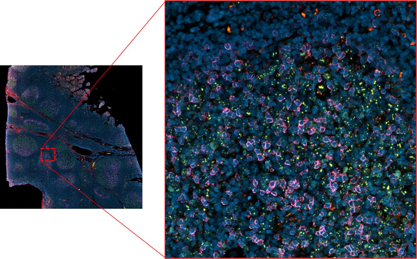 Immunofluorescent staining in FFPE human tonsil of Panel 4. Ki67 (green), PD1 (red), CD80 (purple)