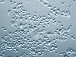 Bronchial Epithelial Cells