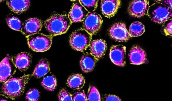 Normal Human Bronchial Epithelial Cells | Mattek - Part of Sartorius