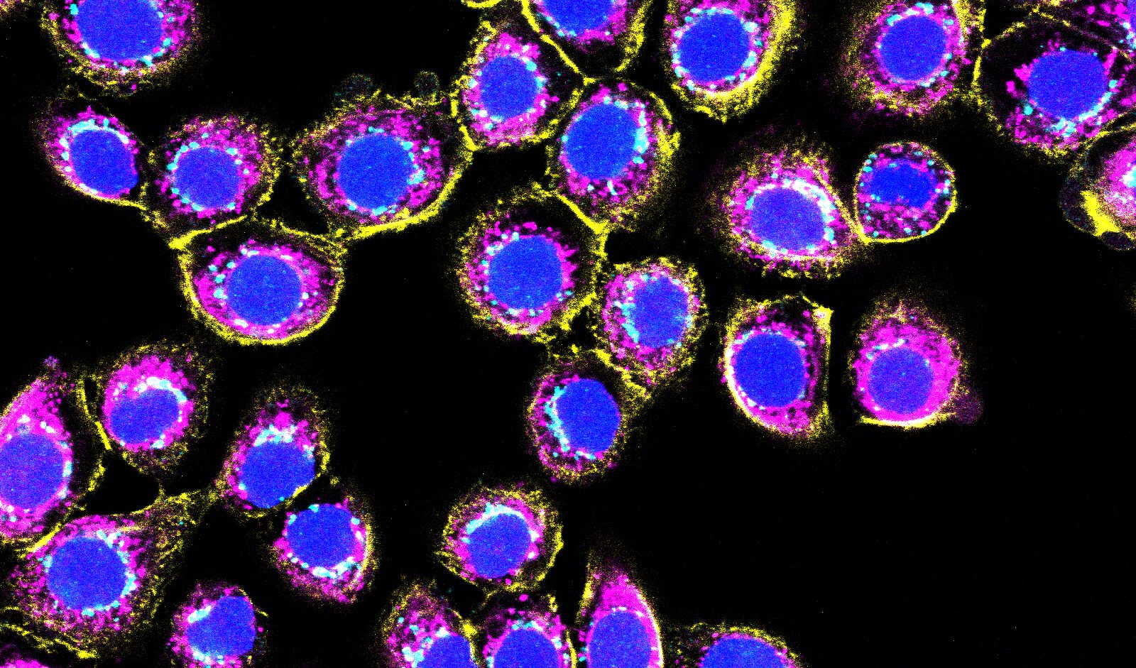 60 times zoom confocal image of NHBE-CRY - Golgin97 (light blue), MitoTracker (purple), Phalloidin (yellow), DAPI (blue), 60x