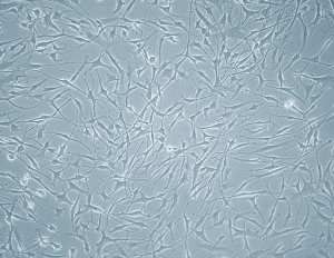 Bronchial Fibroblasts