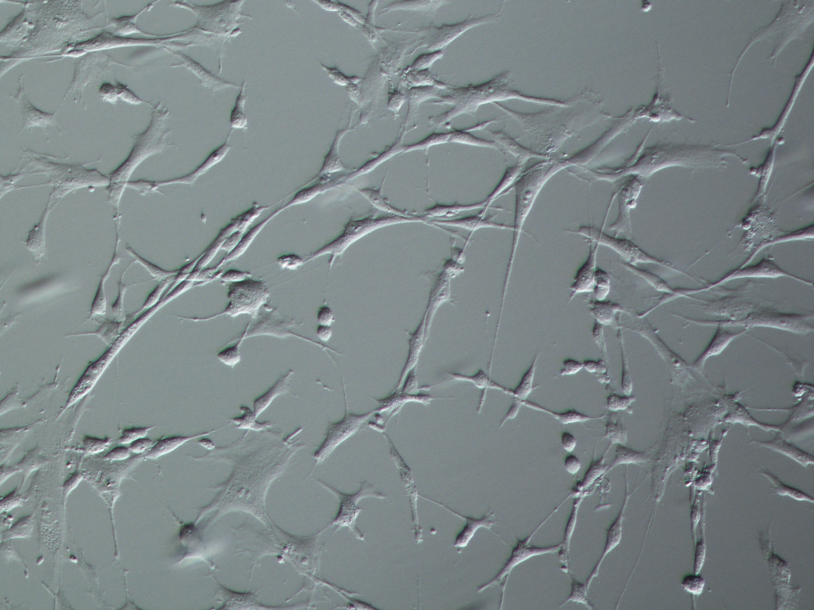 Bronchial Fibroblasts Phase Contrast