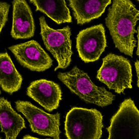 Corneal Epithelial Cells