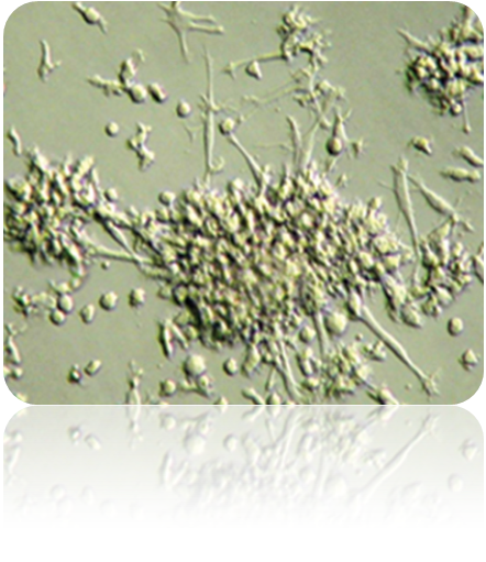 Dendritic Cells