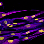 60 times zoom confocal image of NHDF-CRY-NEO - Vimentin (purple), Phalloidin (blue), DAPI (yellow)