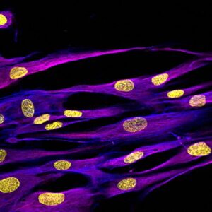 Nhdf Normal Human Dermal Fibroblasts | Mattek - Part of Sartorius