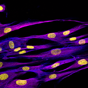 Primary Human Dermal Fibroblasts