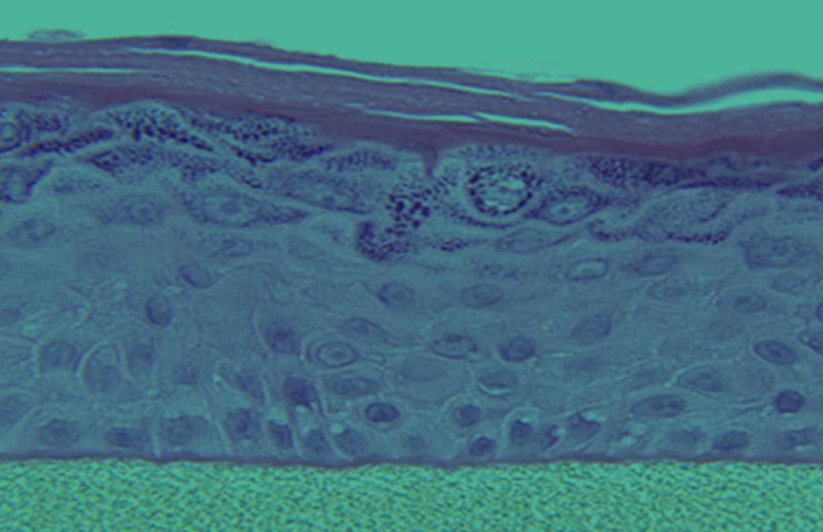 EpiDerm™