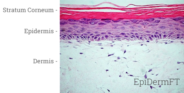 EpiDermFT Histology