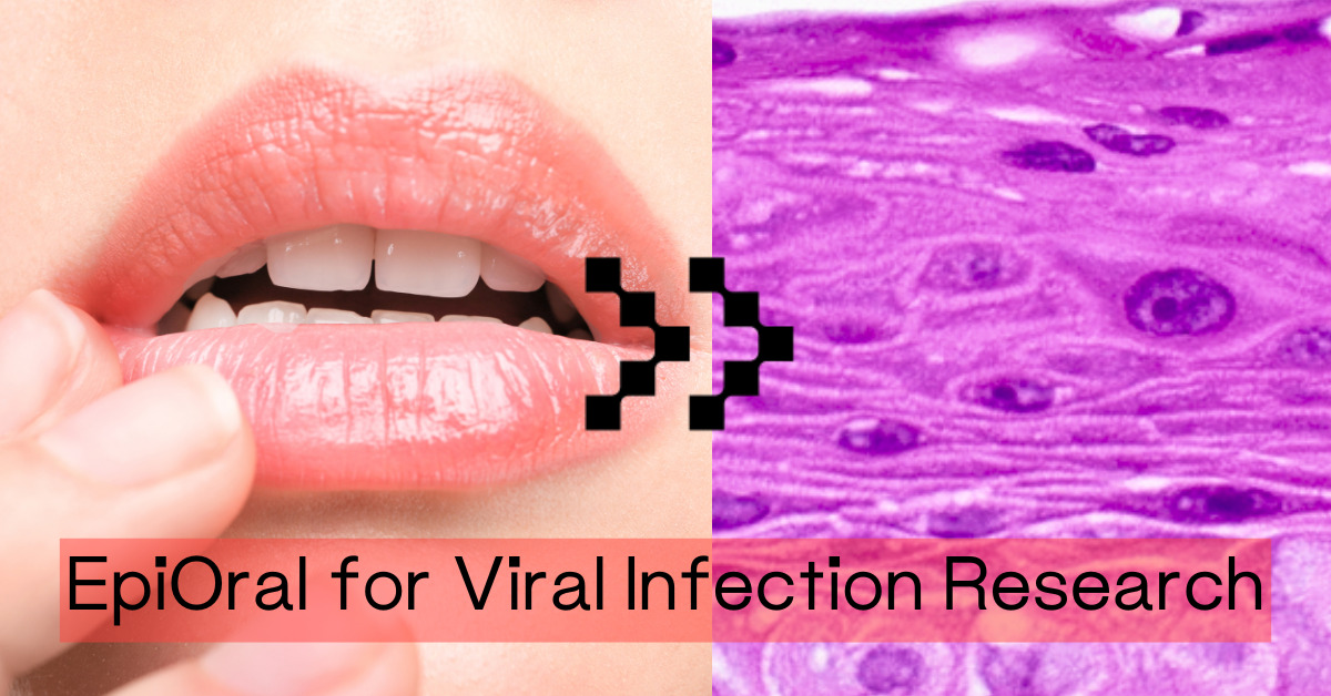 EpiOral Demonstrates Improved Recapitulation of Oral Mucosa for Viral Infection Compared to Traditional 2D Culture