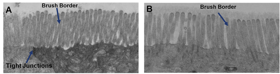 Fig 1A