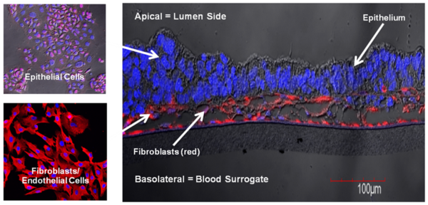 Fig 1B