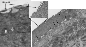 Ultrastructural features of EpiCorneal. Apical cell layer of reconstructed tissue. Open arrows point to microvilli on the surface of the tissue. Tight junctions (white arrows) and desmosomes (closed arrow) are observed at the junction of adjacent epithelial cells.
