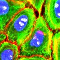 NHEK-CRY-NEO – Cytokeratin 14 (green), Phalloidin (red), Ki67 (white), DAPI (blue), 180x