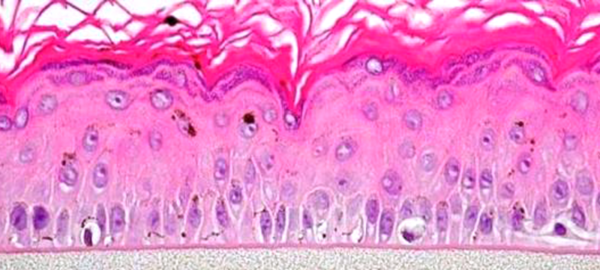 MelanoDerm tissue model histology image