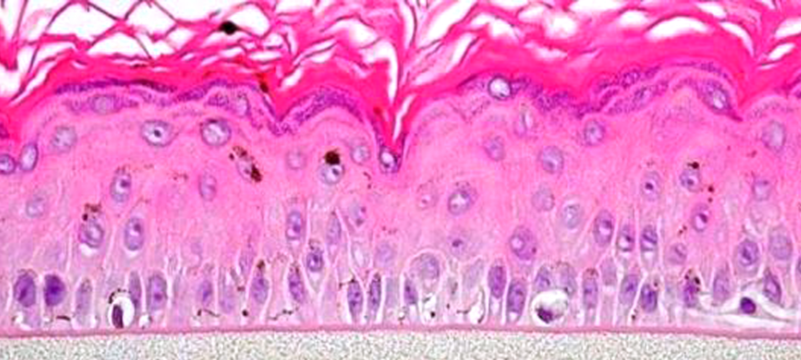 MelanoDerm Histology