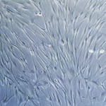 Bright field image of human mesenchymal stem cells