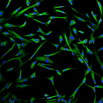 Confocal image of NHBF - DAPI (blue), Vimentin (green)