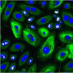 60 times zoom confocal image of NHCE-CRY - Cytokeratin3/12 (green), Ki67 (white), DAPI (blue)