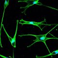 NHM-CRY-NEO – MEL-5 (green), DAPI (blue), 60x